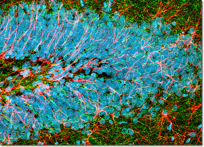 Rat Brain Hippocampus Coronal Thick (30-Micrometer) Section