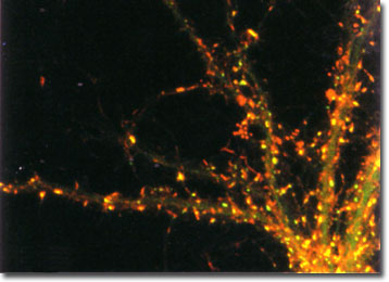 Mouse Hippocampal Neurons