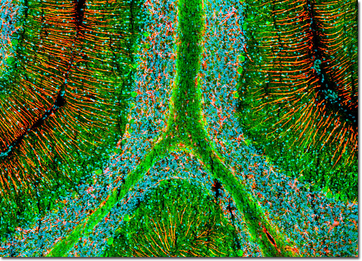 Cerebellum