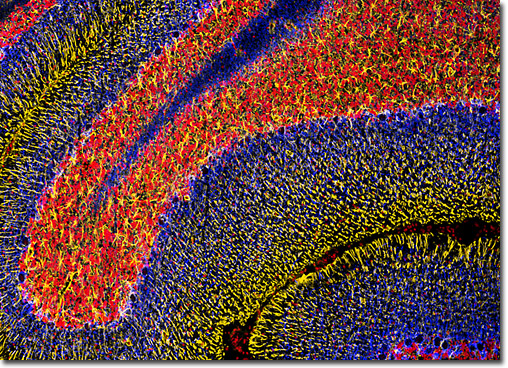 Cerebellum