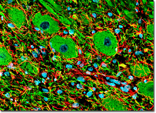 Medulla Oblongata