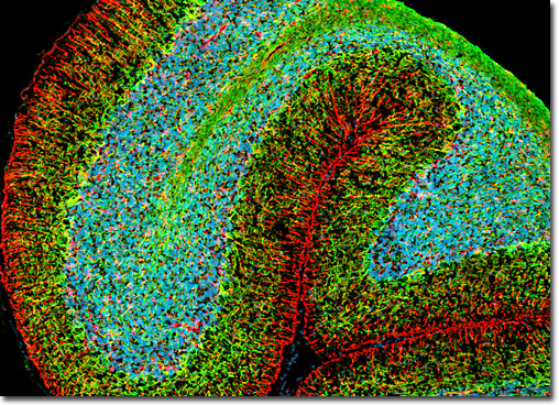 Cerebellum