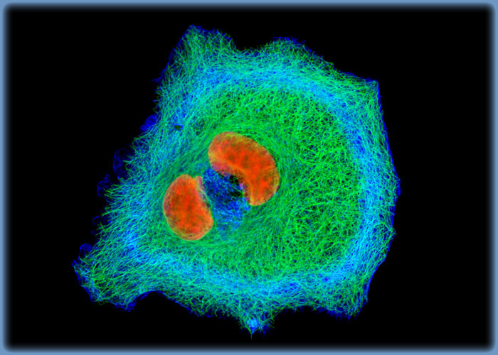 Human Cervical Adenocarcinoma Cells (HeLa Line)