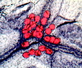 Fat-Stained Adipose Tissue