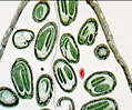 Shepherd's Purse (Capsella) Embryos