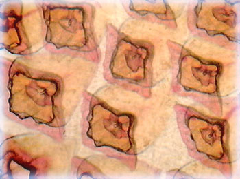 Dogfish Shark Placoid Scales