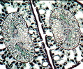 Pine Needle Thin Section