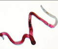 Human Blood Fluke (Schistosoma mansoni)