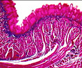 Trichinella Larvae in Muscle Tissue