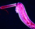 Acanthocephala (Spiny-Headed Worm)