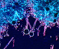 Mold (Aspergillus) Conidiophores