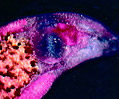 Trematode Flukes (Echinostoma revolutum)