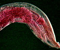Pinworms (Enterobius vermicularis)