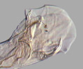 Hookworm (Ancylostoma duodenale) Copulatory Bursa