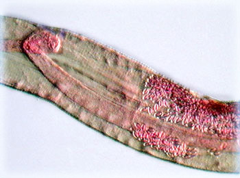 Pinworm (Enterobius vermicularis)