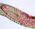 Pinworm (Enterobius vermicularis)