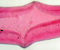 Blood Fluke (Schistosoma mansoni)