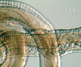 Trichuris Whipworms