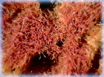 Grass Sponge (Spongia species)
