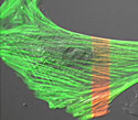 Gray Fox Lung Fibroblast Cells with dEos Actin