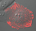 Gray Fox Lung Fibroblast Cells with mTagRFP Zyxin