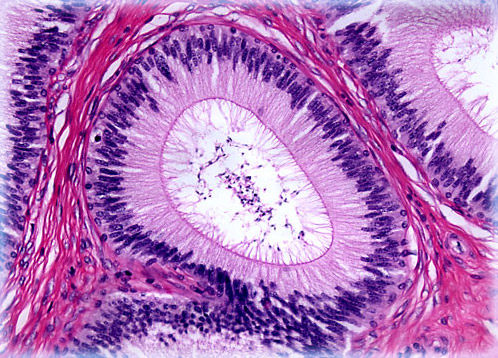 Epididymis