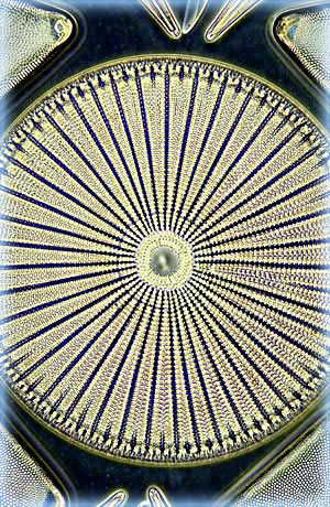 Arachnoidiscus ehrenbergi