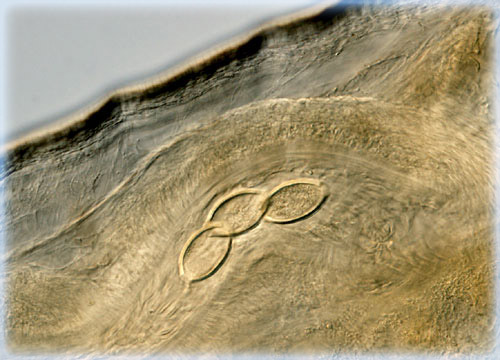 Whipworm (Trichuris) Eggs