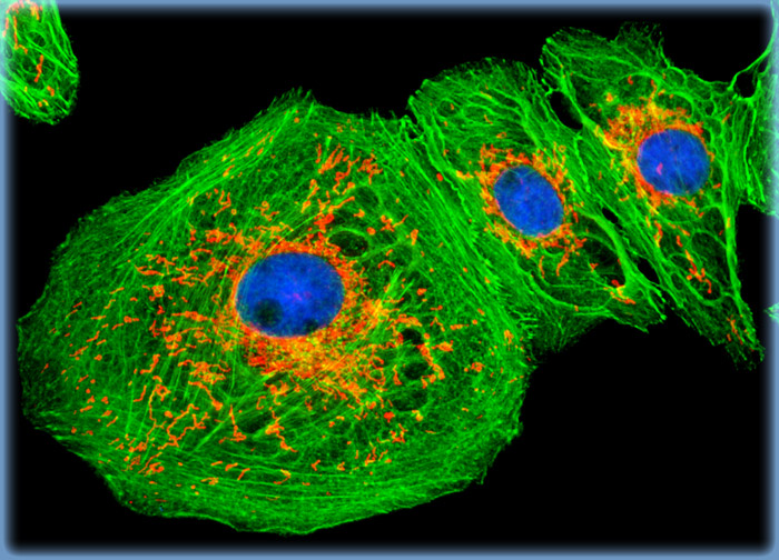 Normal African Green Monkey Kidney Epithelial Cells (Vero)