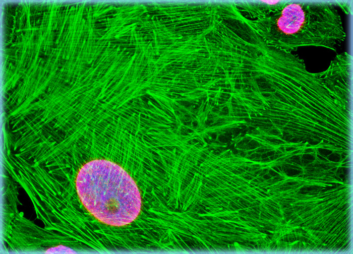Normal African Green Monkey Kidney Epithelial Cells (Vero)