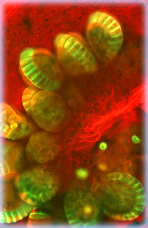 Fern Spores