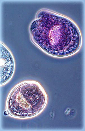 Hydatid Disease